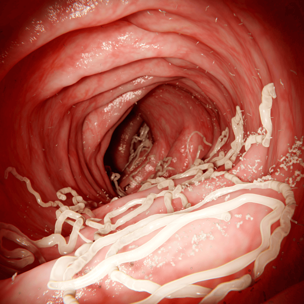 Roundworm